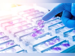 ALIO provides optimal Motion Control Solutions for the dynamic Digital Pathology Sector